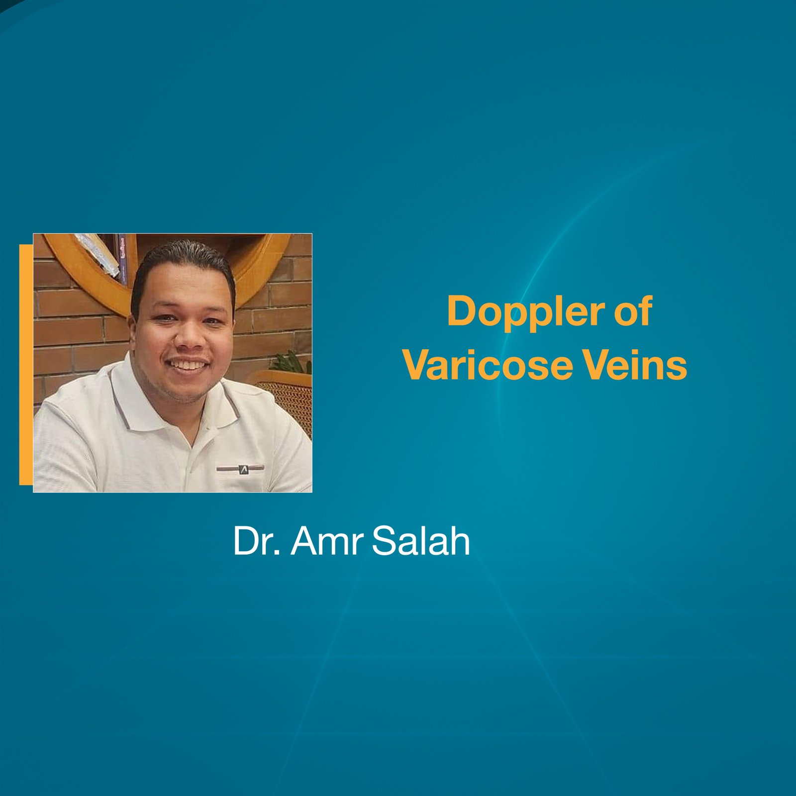 Doppler of Varicose Veins