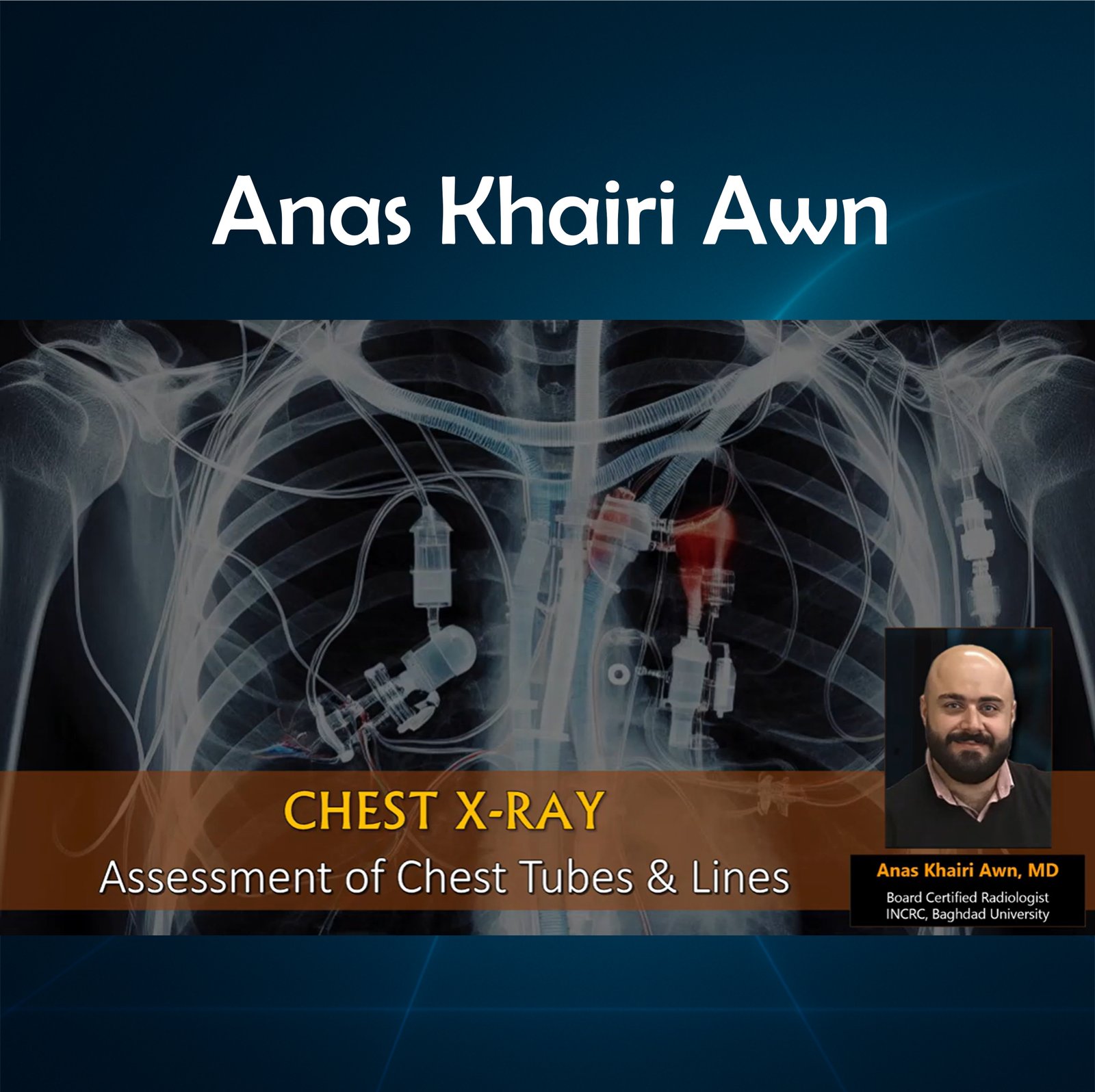 1 - Assessment of Chest Tubes & Lines