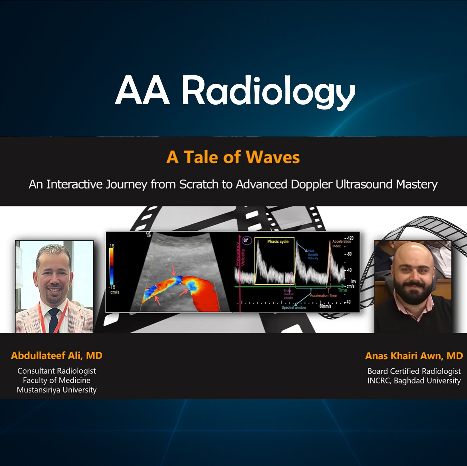 1- Top Doppler tips to master the basics, angles, PRF, terminology & benefit from the artifacts