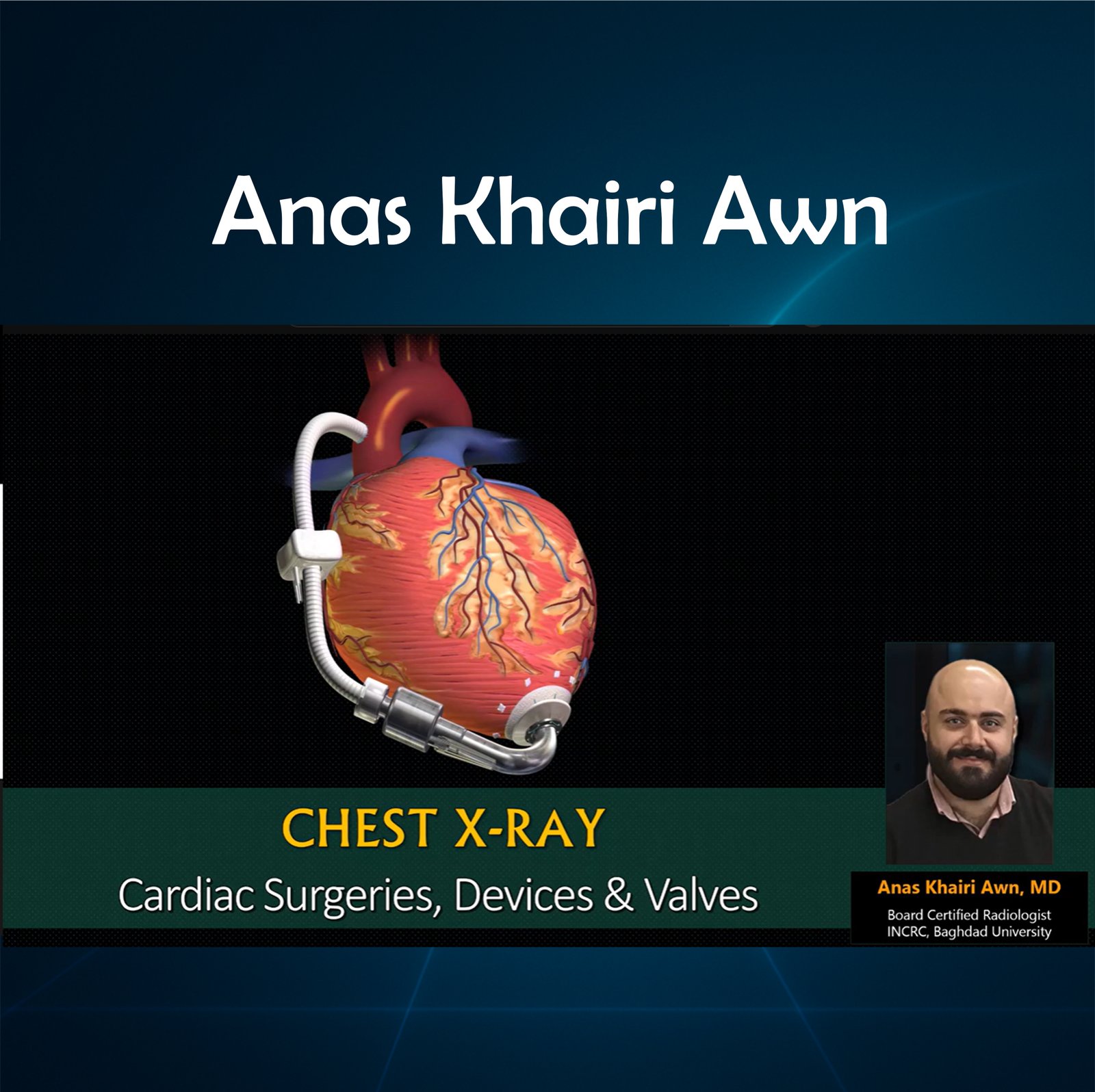 2 - Cardiac Surgeries, Devices & Valves
