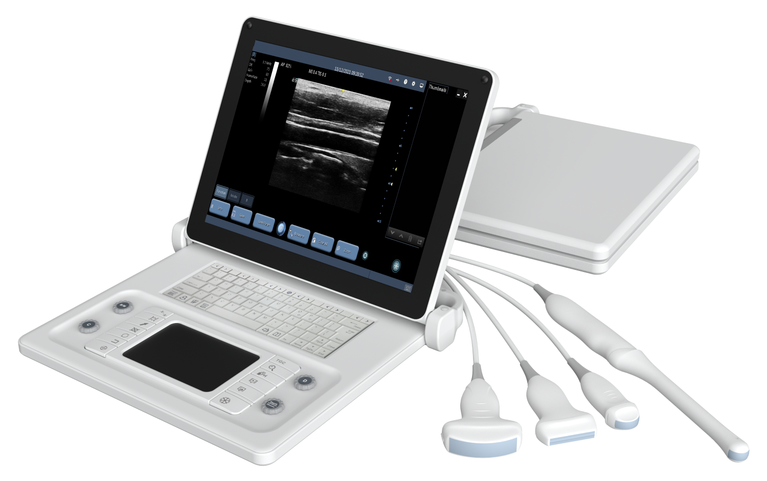 F6 BW Ultrasonic diagnostic imaging system