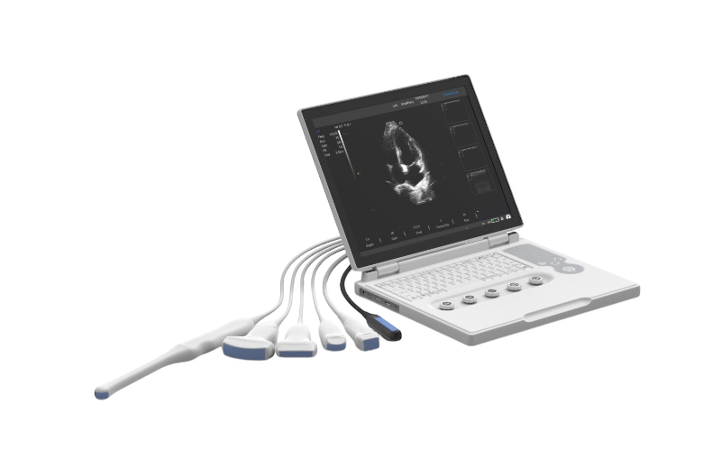 Q60 Ultrasound B/W & Colour Doppler