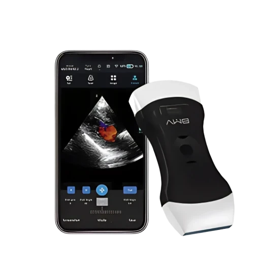 Ultrasound Wireless