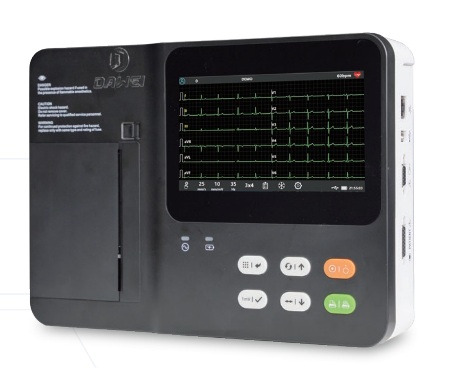 ECG